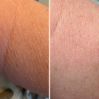 A customer's arm before and after using the Wildpier Luxe exfoliating glove for crepey skin