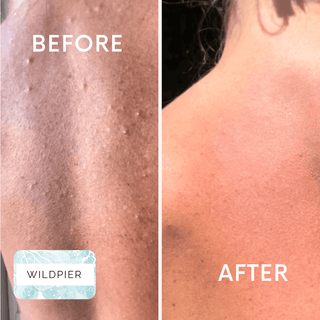 Wildpier™ Deep Exfoliating Towel