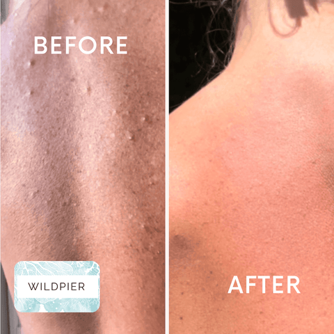 Wildpier™ Deep Exfoliating Towel