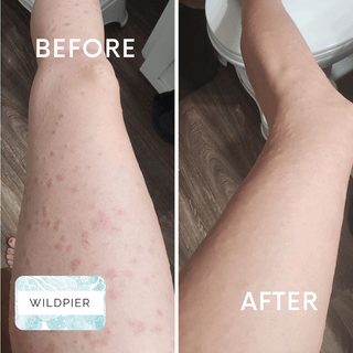 Wildpier™ Ultimate Deep Exfoliating Glove