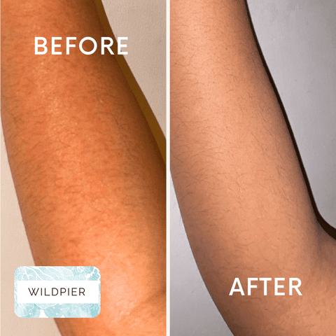 Wildpier™ Deep Exfoliating Glove and Konjac Sponges Bundle - Wildpier Beauty