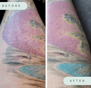 Wildpier™️ Ultimate Deep Exfoliating Glove - Wildpier Beauty