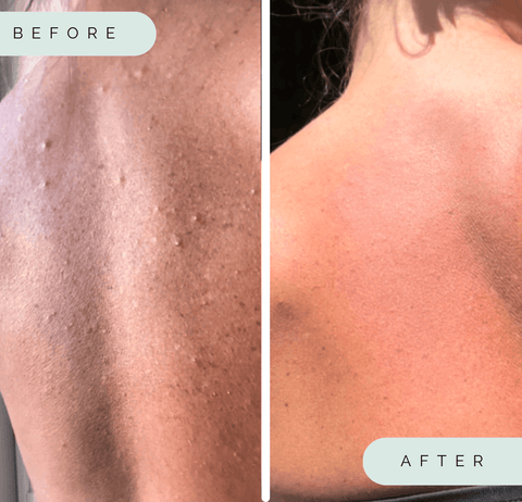 Wildpier™️ Deep Exfoliating Towel - Wildpier Beauty