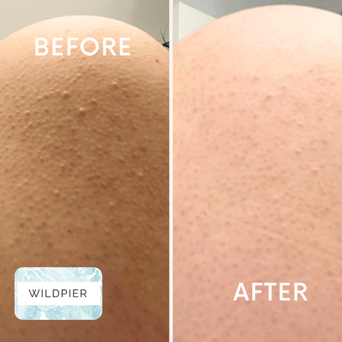 Wildpier™️ Deep Exfoliating Glove and Konjac Sponge Double Bundle - Wildpier Beauty