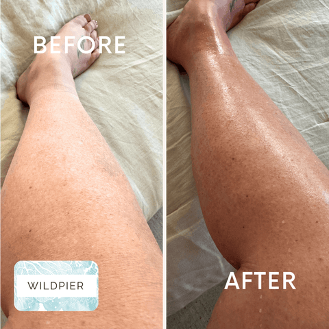 Before and after comparison of legs with Wildpier branding.