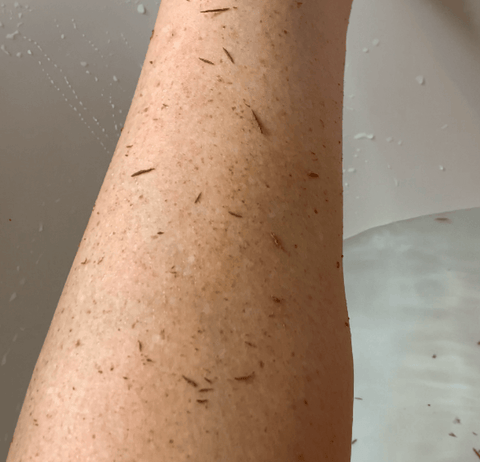 Skin Peeling - Front Leg